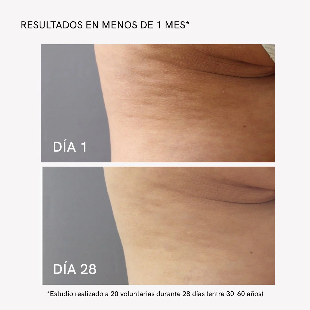 RF Body Slim - Image 5