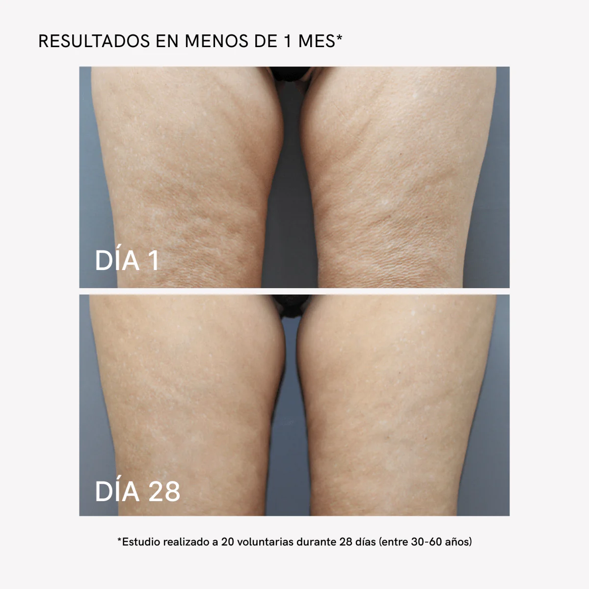 RF Tratamiento Corporal Completo - Image 5