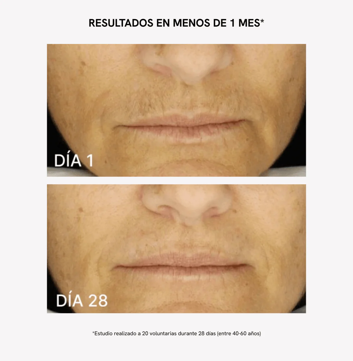 RF Tratamiento Flacidez Facial Extra Colágeno - Image 5