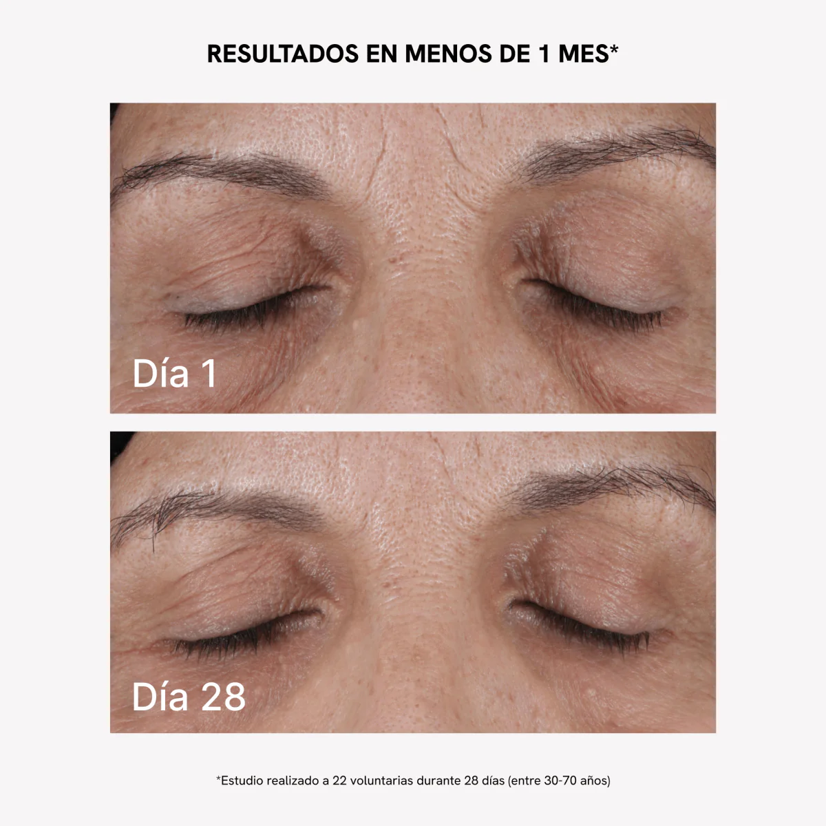 RF Tratamiento Flacidez Facial Extra Colágeno Plus - Image 5