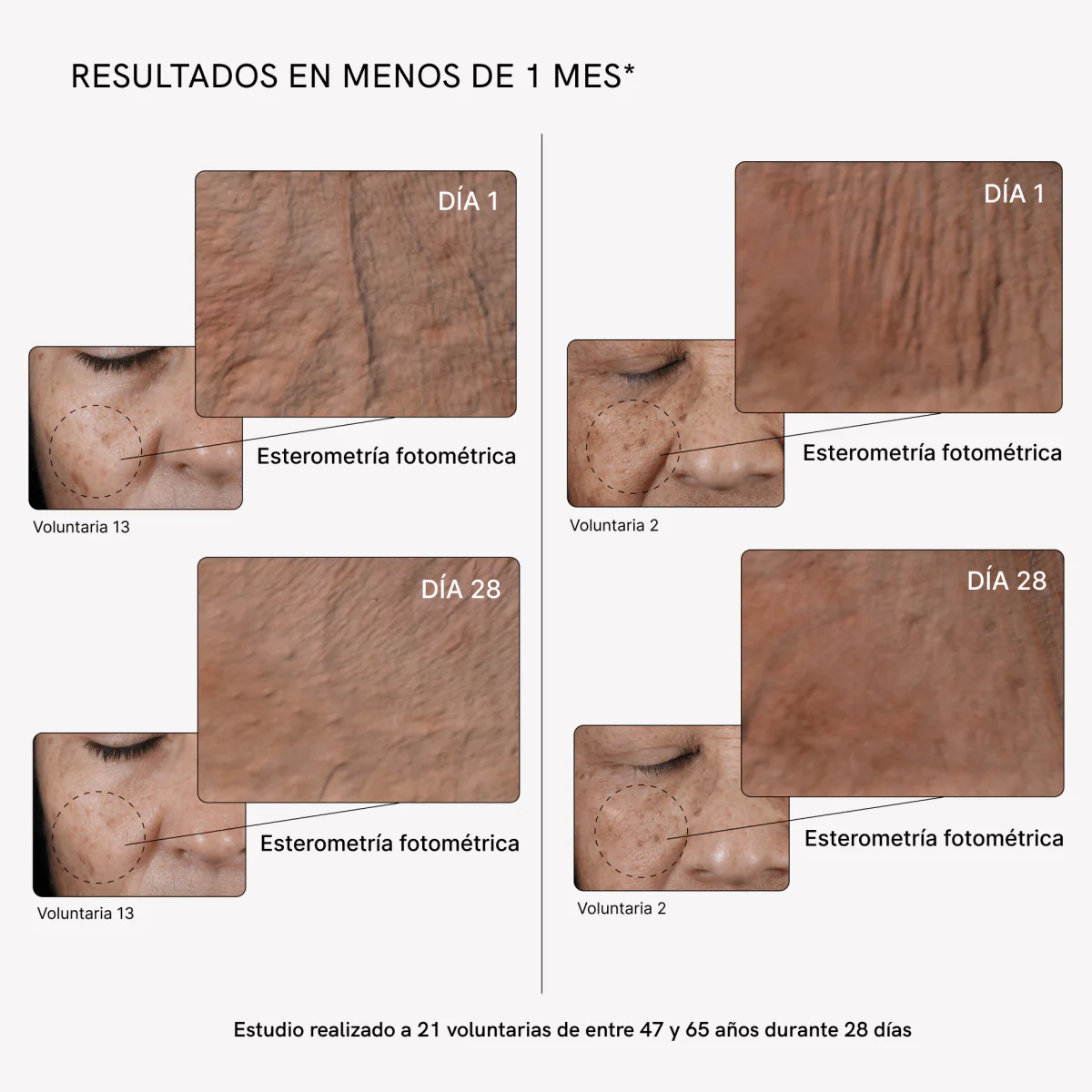 RF Tratamiento Flacidez Facial Plus Completo - Image 5
